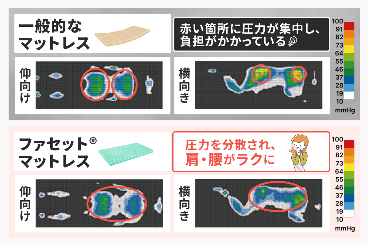 ファセット® の特長「六角スリット」が圧力を分散。